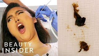 How Earwax Is Professionally Extracted  Beauty Explorers  Insider Beauty [upl. by Nylynnej189]