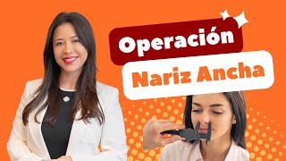 Operación Nariz Ancha 👃🏻 [upl. by Yentnuoc]