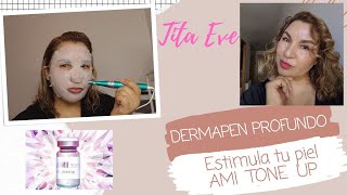 Resultados Impresionantes con DERMAPEN PROFUNDO AMI TONE UP titaeve esteticamesoterapiadermapen [upl. by Tnomyar]