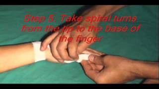 Finger tip Recurrent Bandage [upl. by Biagi]