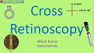 Cross Retinoscopy  Retinoscopy Procedure [upl. by Cassady]