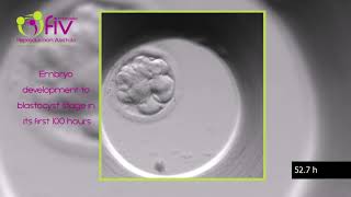 TimeLapse  Embryo development ENG first 100 hours [upl. by Mouldon]