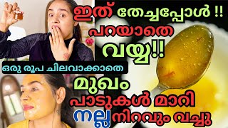 തെളിവടക്കം സത്യം😲മുഖകുരുപാടുകളുംമാറും pores മാറും💯True🫢Face Brightening ZeroCost Cream At Home [upl. by Ygief]