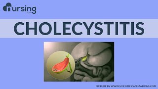 Breaking down CHOLECYSTITIS and understanding what this is Nursing School Lesson [upl. by Birchard483]