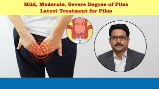 Treatment options for piles  Dr Sujay B R  Nano hospitals bengaluru [upl. by Ennazzus]