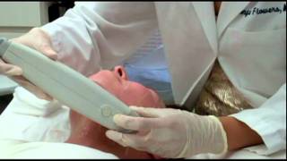 Ulthera Procedure LIVE VIDEO [upl. by Ivel899]