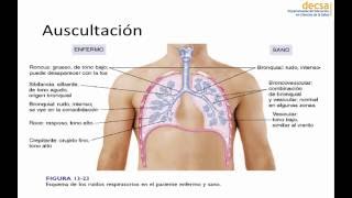 Exámen Físico Pulmonar [upl. by Price]