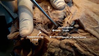 Parotid Gland II  Structures within [upl. by Disraeli]