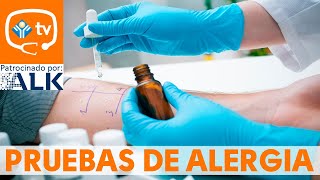 ¿Cómo se realizan las pruebas de alergia [upl. by Dirfliw577]