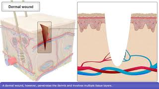 Stages of Wound Healing [upl. by Neyuh]