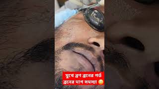 Acne scar acne spot acne problem solve in Bangladesh [upl. by Oira759]