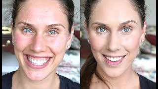 HO WTO AntiRedness Foundation Routine Cover Rosacea Acne Cover A Sunburn With Makeup Etc [upl. by Enoyrt]