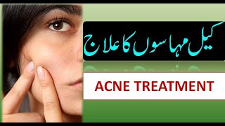 Acne Treatment in Urdu [upl. by Atihana]