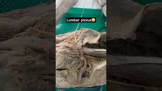 Lumbar plexus anatomy medico fypyoutube fyp [upl. by Anawek]