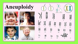 aneuploidy [upl. by Ellehcrad54]