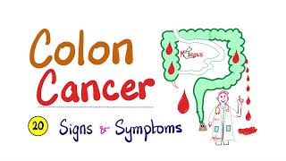 Colon cancer  20 Signs amp Symptoms  Clearly Explained  Cancer Series [upl. by Atsugua]