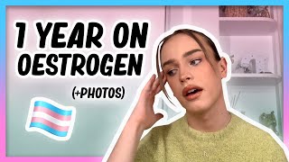 1 YEAR ON OESTROGEN Transition update with photos  Hormone Diaries [upl. by Astraea]