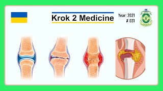 Krok 2 Medicine  Year 2021  031 Ministry of Public Health of Ukraine [upl. by Anyg]