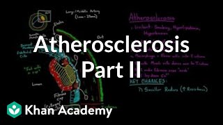 Atherosclerosis  part 2  Circulatory system diseases  Health amp Medicine  Khan Academy [upl. by Leemaj]