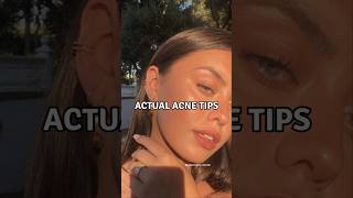 6 Actual Acne Tips viralshorts acnetreatment acnescars [upl. by Shaine603]