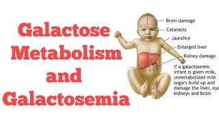 Galactose metabolism  Biochemistry [upl. by Koah541]