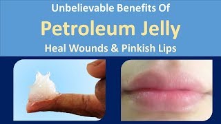 Unbelievable Benefits Of Petroleum Jelly  Heal wounds amp Pinkish lips [upl. by Evers]