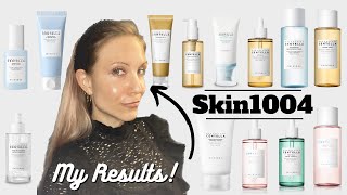 Skin1004 Review amp Whats the Difference Between the Lines [upl. by Johannah406]