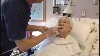 Oral Care for Residents with Dementia 5 of 6 [upl. by Ferrand]