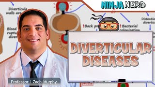 Diverticular Diseases  Clinical Medicine [upl. by Idurt]