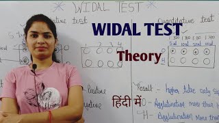 Widal Test  Widal Test For Typhoid  Typhoid test in hindi  Typhoid disease test  विडाल टेस्ट [upl. by Cesaria325]