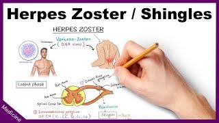 Herpes ZosterShingles Symptoms Diagnosis Treatment [upl. by Lilahk396]