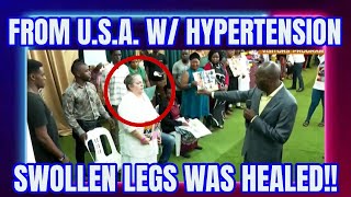 🔴KAKANDE TESTIMONIES  FROM USA WITH HYPERTENSION AND SWOLLEN WAS HEALED INSTANTLY JC5455 [upl. by Oliver]