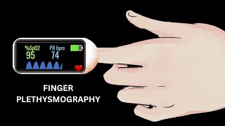 PY516 Arterial pulse tracing using Finger Plethysmography  Pulseoximeter [upl. by Nnayelsel149]