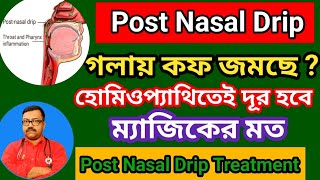 গলায় কফ জমে   হোমিওপ্যাথিতেই দূর হবে ম্যাজিকের মত  homeopathy medicine for Post Nasal Drip [upl. by Odnanreh448]