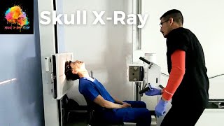 XRay Positioning  Skull SMV view ☢️ YourXRayTech [upl. by Baillie]