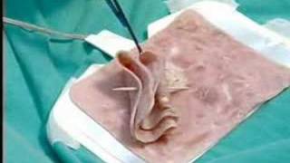 Endoscopia quotLa Historia no Contadaquot parte 6 67 [upl. by Glynn423]