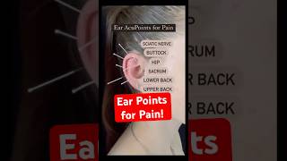 Ear Acupuncture for Back Pain Shorts [upl. by Aztinaj]