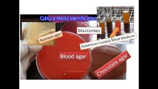 Culture media the simplest way of identification  Blood MacConkey  Chocolate RCM Nurient agar [upl. by Silverman]