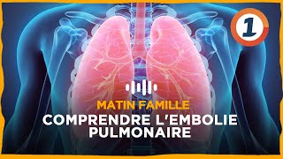 Comprendre lembolie pulmonaire [upl. by Notlem]