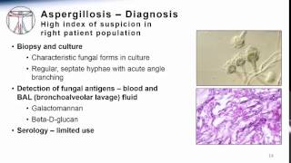 Aspergillosis [upl. by Ardnaed]