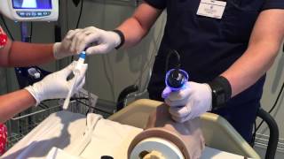 GlideScope Intubation Assist [upl. by Rimidalg]