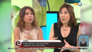 Red de salud  Todo sobre el Lupus  241115 [upl. by Nyleve]