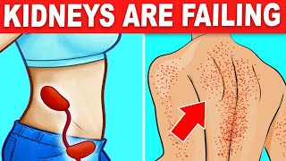 10 Signs Your Kidneys Are Crying For Help [upl. by Ximenez]