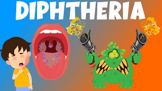 Diphtheria  Symptoms causes diagnosis and treatment  Video for Kids [upl. by Audra]