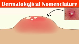 Describing Skin Lesions Dermatological Nomenclature  Macule Papule Pustule Vesicle amp Others [upl. by Seyer]