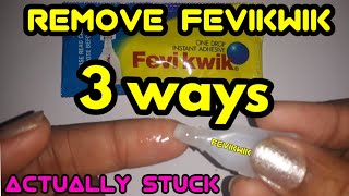 how to remove fevikwik from hand [upl. by Hannis]