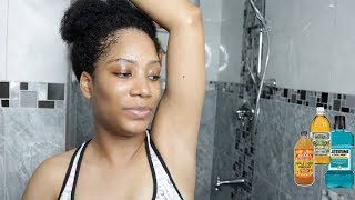 HOW TO LIGHTEN AND DETOX DARK UNDERARMS  DAILY ROUTINE  NATURALLY FREE [upl. by Earaj392]