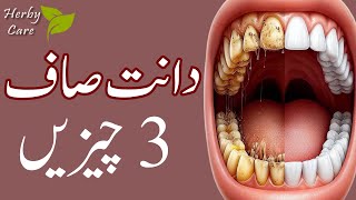 Top 3 Effective Home Remedies to Remove Plaque and Tarter [upl. by Valeta293]