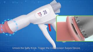 LangHe Medical  CircCurer  Disposable Circumcision Suture Device  2nd generationDemo [upl. by Castro]