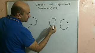 Cirrhosis and HepatoRenal SyndromeHRS [upl. by Liborio230]